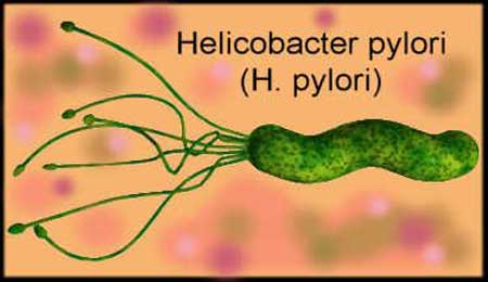 Бактерия хеликобактер Helicobacter Pylori Бактерия хеликобактер Helicobacter Pylori