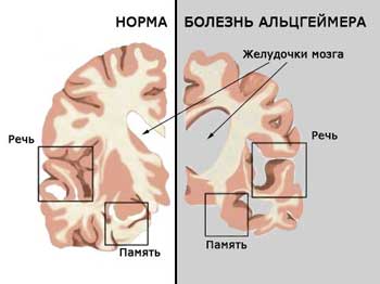 Что такое фосфатидилсерин