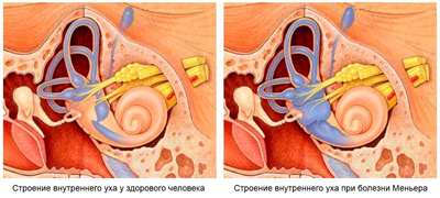 Головокружение: причины и что делать