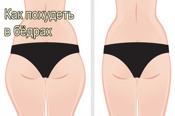 Советы как похудеть в бёдрах Советы как похудеть в бёдрах