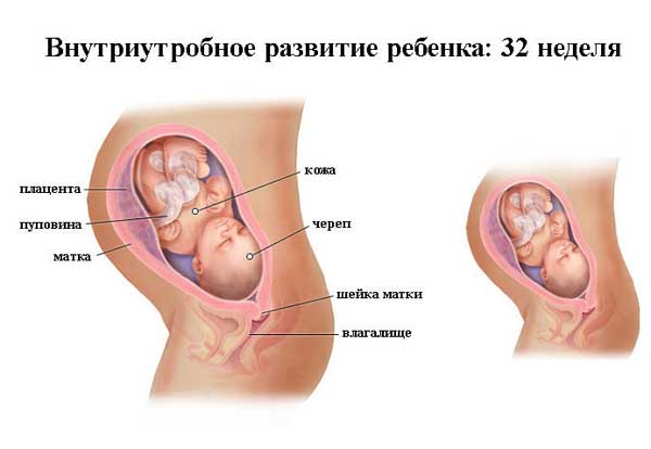32 неделя беременности 32 неделя беременности: что происходит, полезные советы
