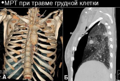 Торакальная хирургия