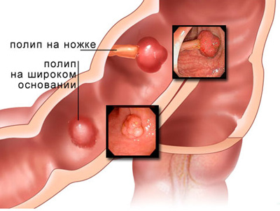 Детская хирургия