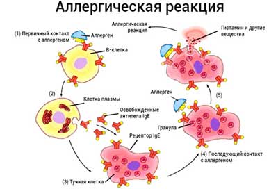 Аллергия на лекарства