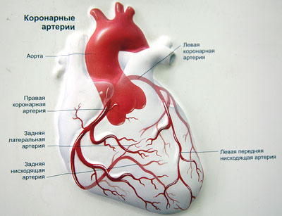 Коронарное стентирование