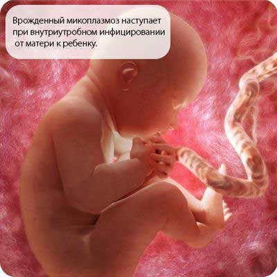 Микоплазмоз