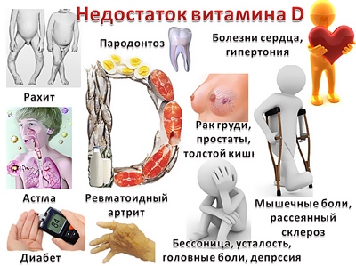 Дефицит витамина Д у детей