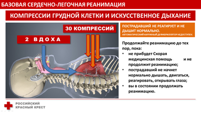 сердечно-легочная реанимация
