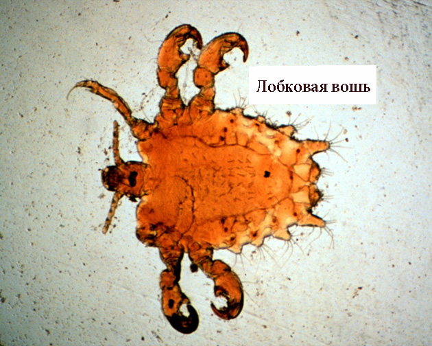 лобковая вошь