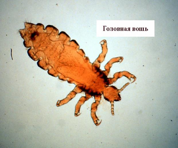 головная вошь