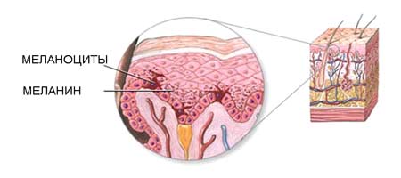 Меланин - причина появления пигментных пятен