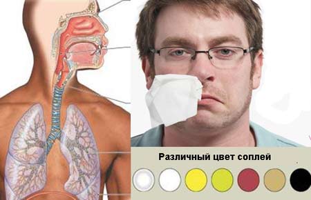 Что означает цвет соплей