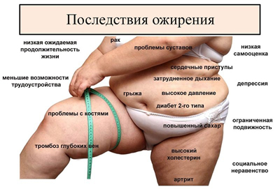лечение ожирения