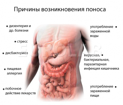 Причины диареи