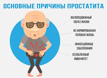 Простатиты у мужчин