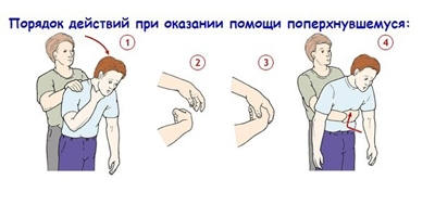 удушье у детей