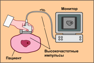 Абдоминальное ультразвуковое исследование