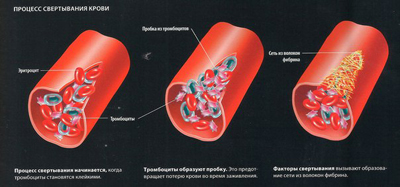 Антикоагулянты