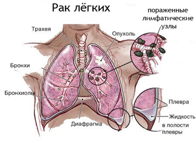 Торакальная хирургия