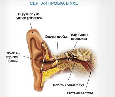 Нарушения слуха у детей