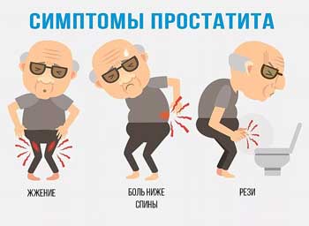 Простатиты у мужчин