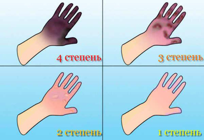 Безопасность зимой