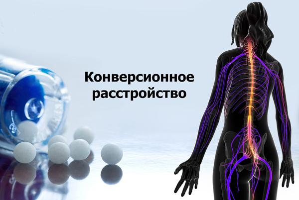 Конверсионное расстройство – описание, причины, диагностика и лечение Конверсионное расстройство – описание, причины, диагностика и лечение