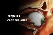 Гипертония и зрение Гипертония и зрение