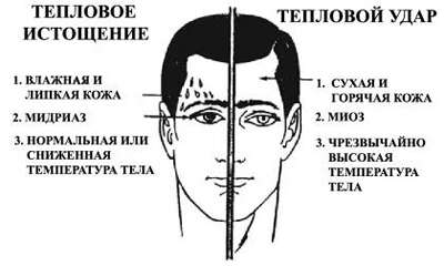 Первая помощь при тепловом ударе