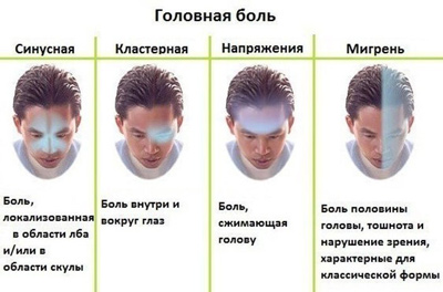 Головная боль: типы, симптомы, причины, лечение