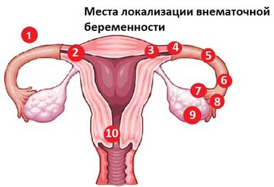 Осложнения при беременности