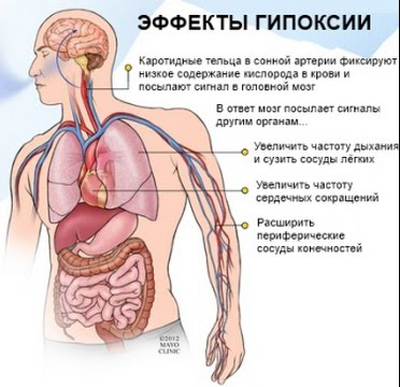 Горная болезнь