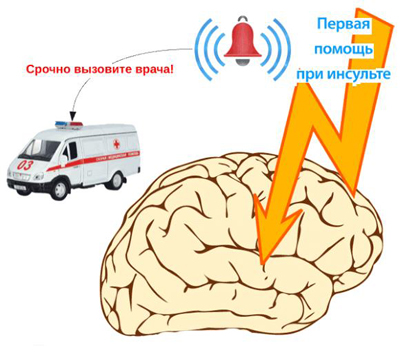 Первая помощь при инсульте