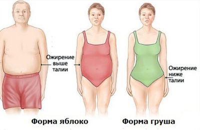 лечение ожирения