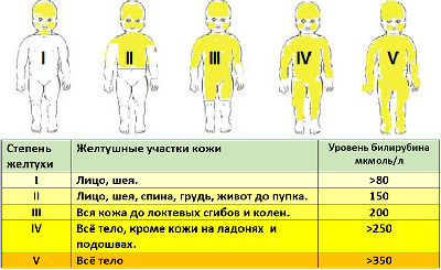Детская хирургия